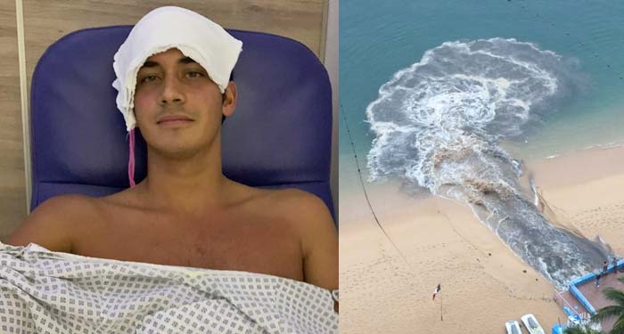 “Me hospitalizaron por nadar en aguas negras de Acapulco”: Nadador
